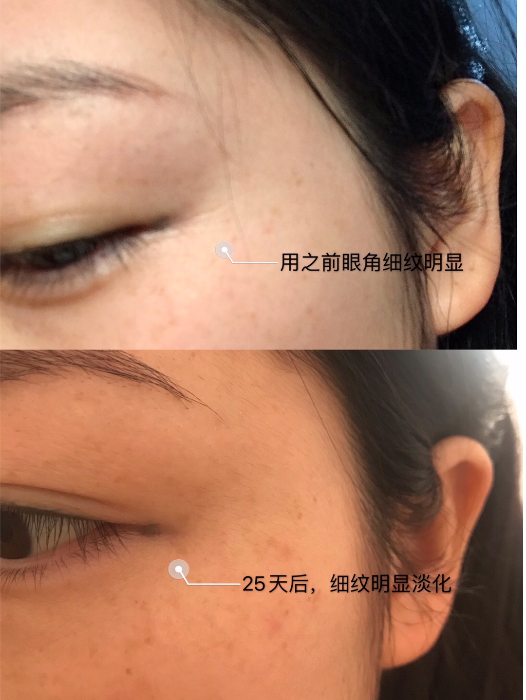 精華—yong_